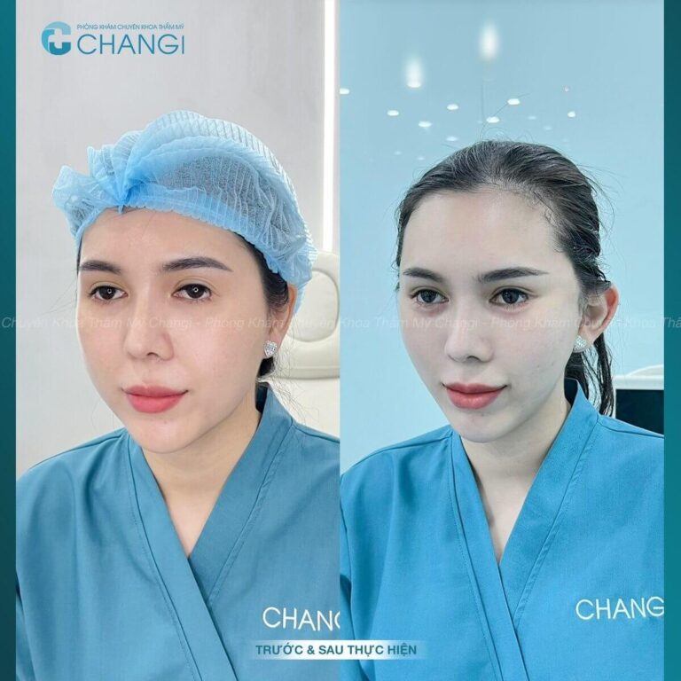 ACF Image