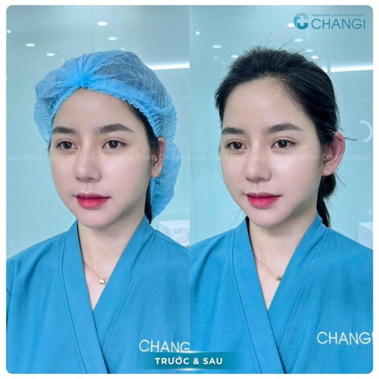 ACF Image
