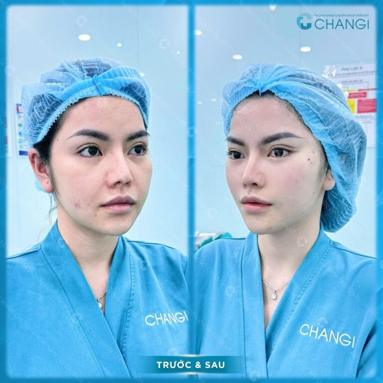 ACF Image