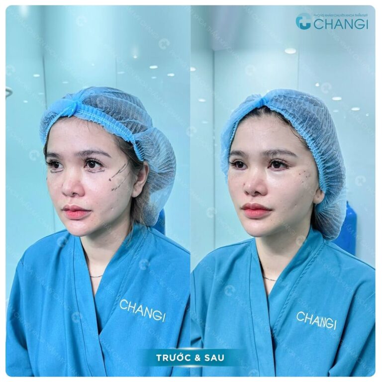ACF Image