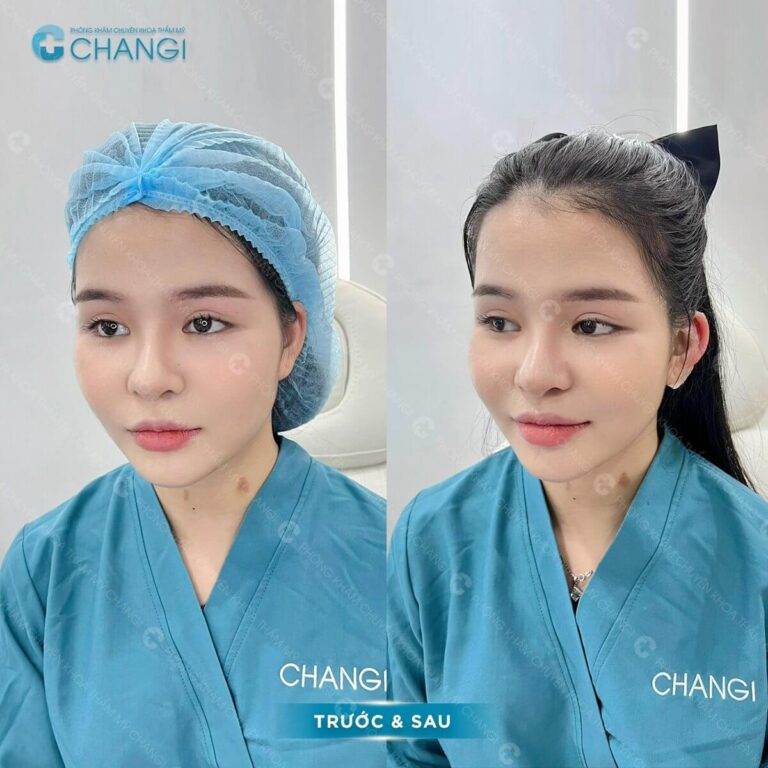 ACF Image